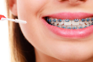 cleaning braces in nashua