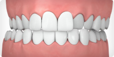 chelian orthodontics