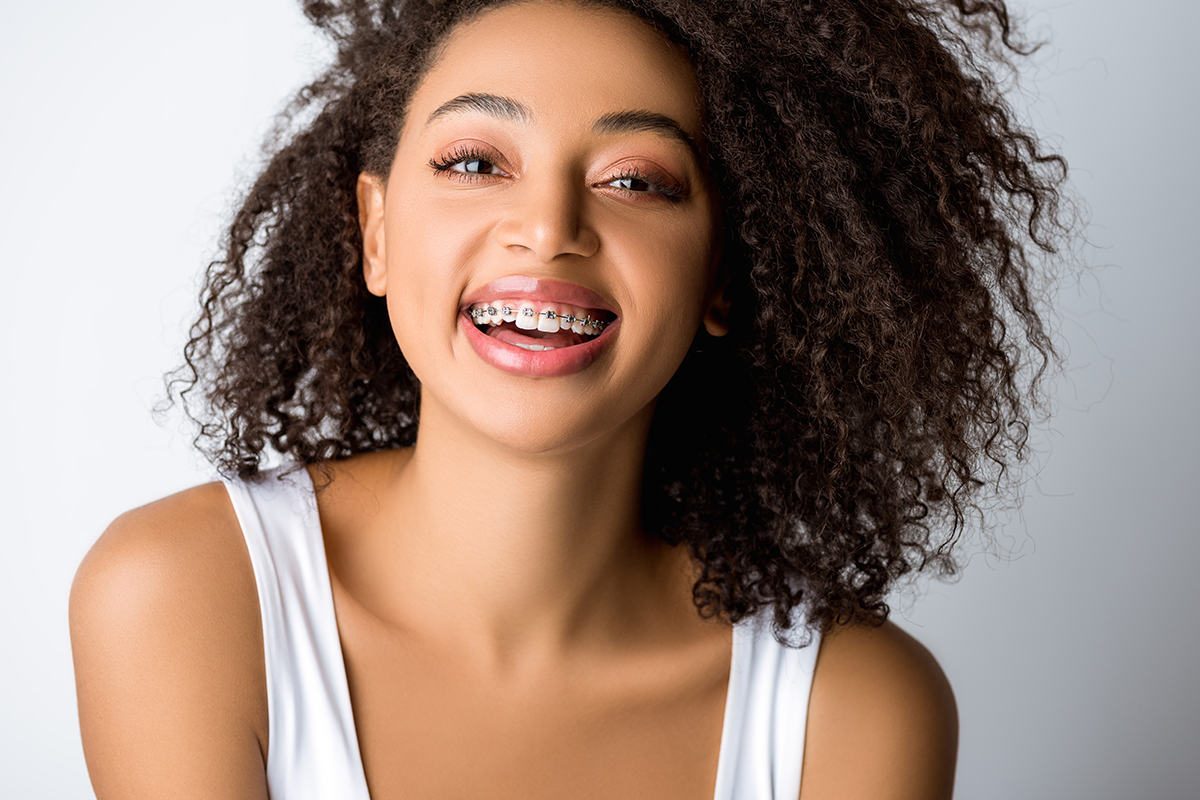 Are Braces Covered by Insurance?
