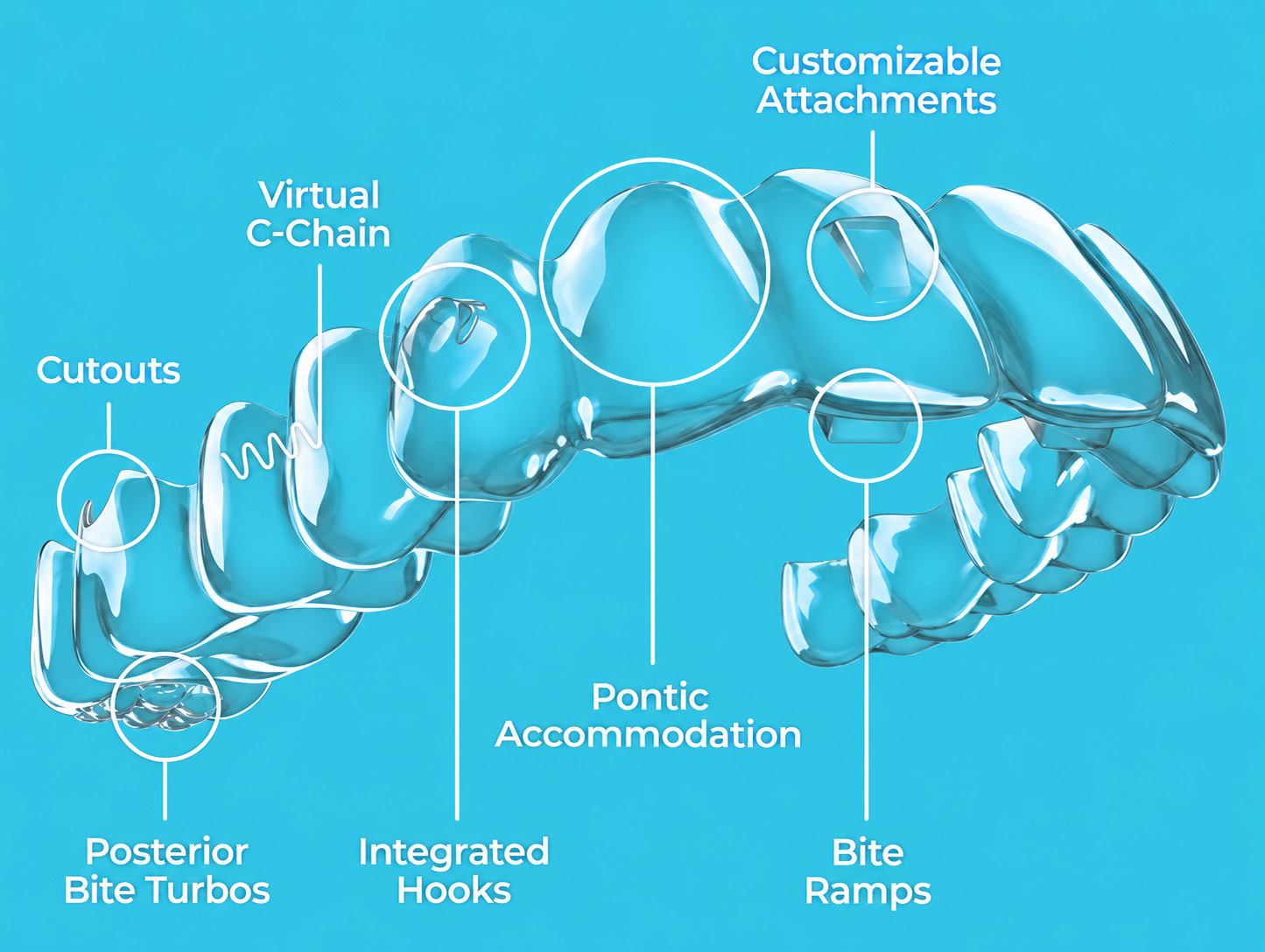 Spark aligner system showing customizable attachments, virtual C-Chain, cutouts, posterior bite turbos, integrated hooks, pontic accommodation, and bite ramps